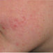Skin2