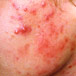 Skin3