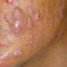 Skin4