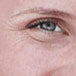 Aging Skin2