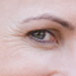 Aging Skin3