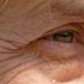 Aging Skin4